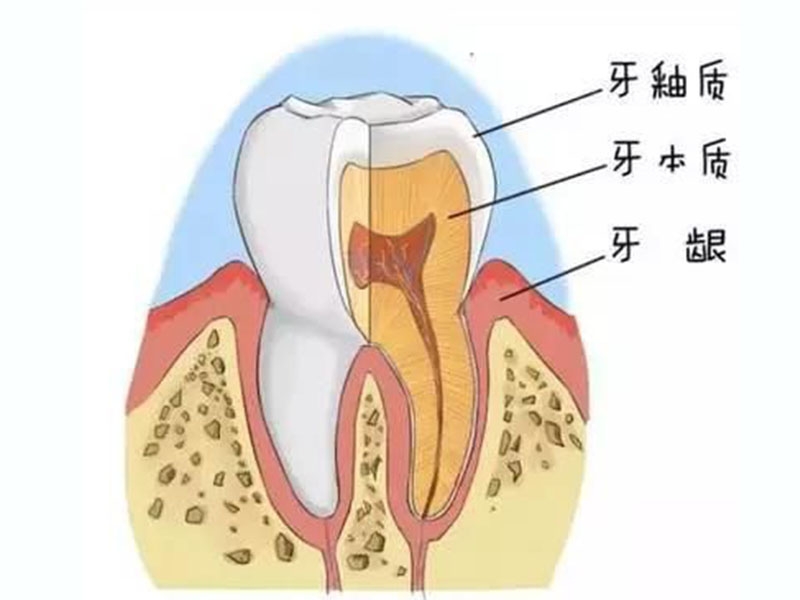 菏泽口腔医院讲解痛起来要命的牙痛，到底怎么办？