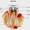 牙髓炎