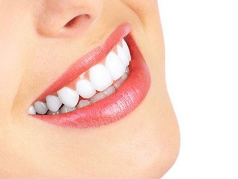 常用的牙齿美白技术有哪几种？